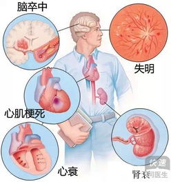 中药湿敷与药物涂抹