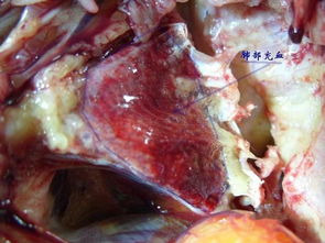 肉鸡猝死因：饲料营养失衡、环境应激
