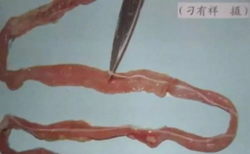 骆驼蟠尾线虫病：骆驼感染寄生虫