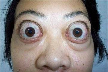 唐印叶子干裂了怎么办？如何恢复其原有光泽