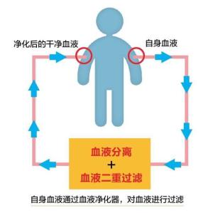 血液净化治疗：清除毒物， 拯救生命