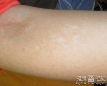 物理冲洗，清除残留