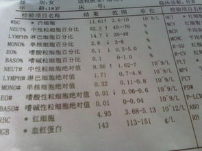 影响因素——是运气还是技术？