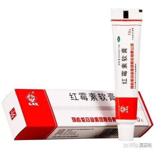治疗菊花瘙痒，哪种药膏最有效