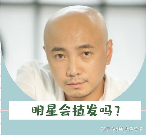 明星植发一般会选择哪些知名植发医院，网红冬一推荐的是哪家？