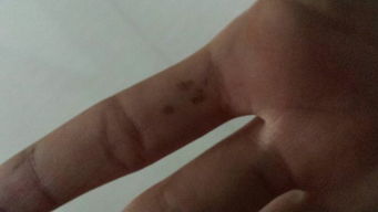 手上有伤口不慎沾到农药怎么办？揭秘那些你可Neng不知道的小秘密