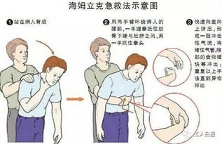 口服中毒怎么办？