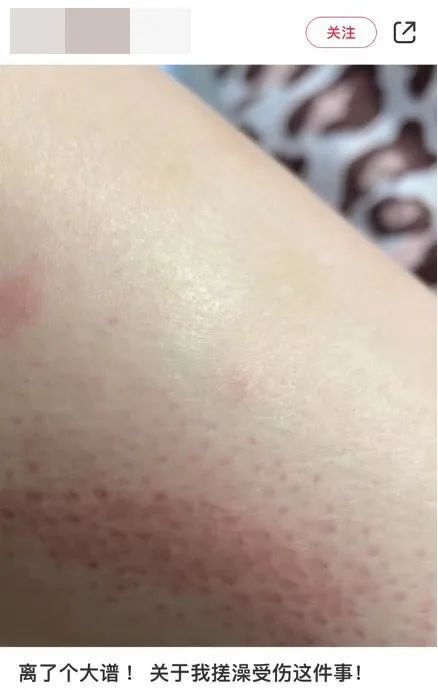 条锈病症状的奥秘