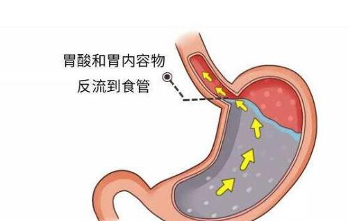 牛瘤胃胀气主要成分有哪些，如何进行有效的诊疗？