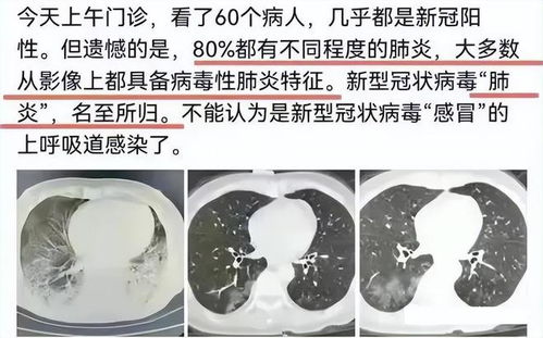 白菜白锈病症状大揭秘