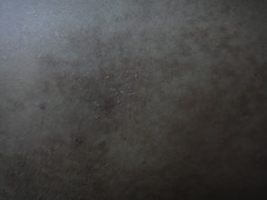 为什么会痒呢？