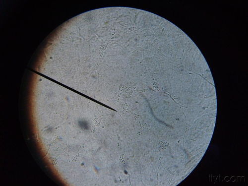 梨锈病菌的形态特征探秘