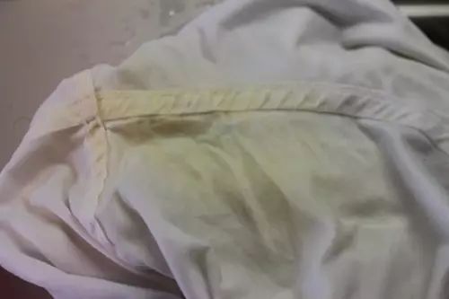 洗衣难题：顽固污渍的烦恼