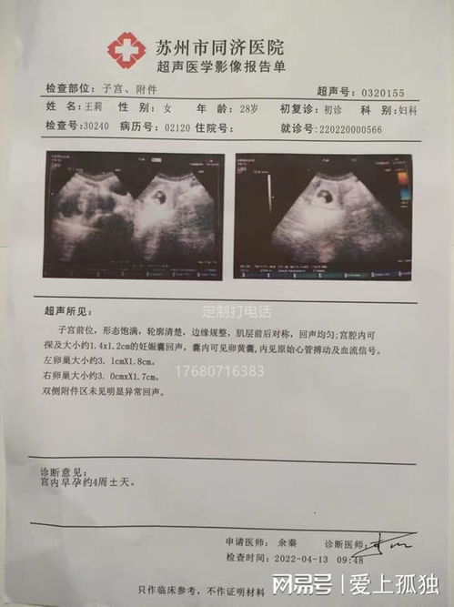 子宫炎评分系统在母猪子宫炎诊断中应用广泛