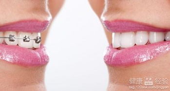 树干弯曲矫正方法