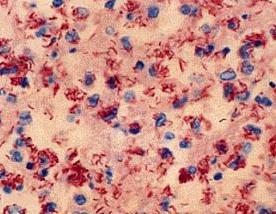 杆菌清——清洁的守护神