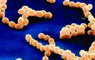 金黄色葡萄球菌， 小样儿你也得怕