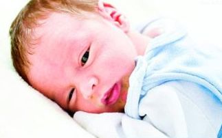 苯丙氨酸：苯丙酮尿症的关键因素