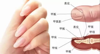 灰指甲的困扰与治疗探索