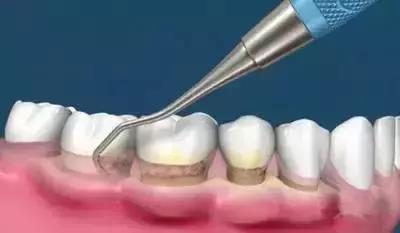 除虫菊多长时间出牙？揭秘种植谜团