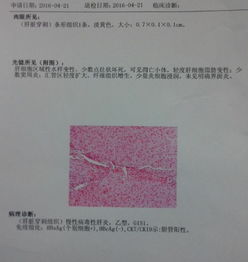 猪咳嗽诊治：病原检测是关键
