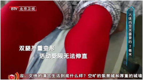 家禽瘫痪非关节感染成因解析