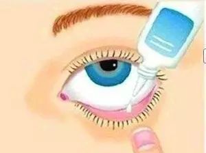 乱点眼药水， 小心事态恶化