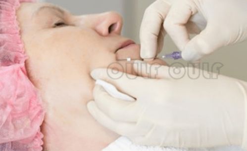 哎呀，这可真是头疼啊