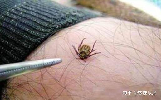 被咬了怎么办？