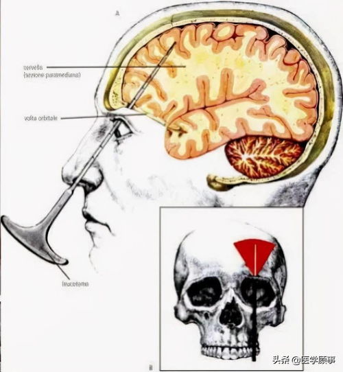 米兰繁殖，从根、茎、叶三大器官入手