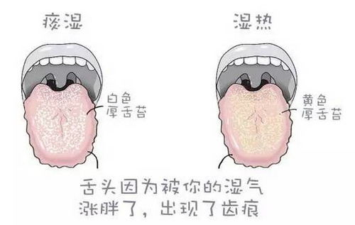 扛板归：清热解毒