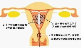 猪肠便秘：区分原发性与继发性，常见于小猪！