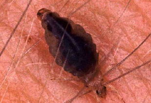 生物制剂：大自然的帮手