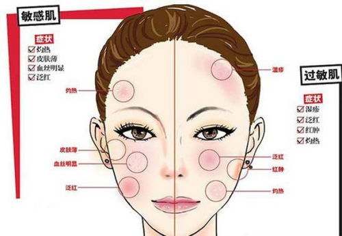 guan与goto喷雾对皮肤过敏的人效果如何？