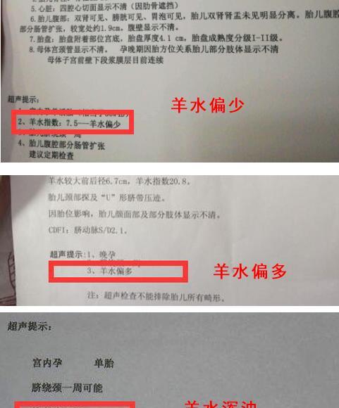 如何挑选高品质烯丙孕素口服液，确保批次化生产质量？