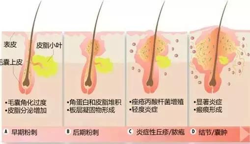 使用农药要注意平安