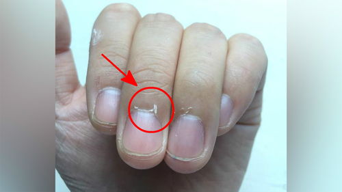 多吃维生素C， 恢复geng快