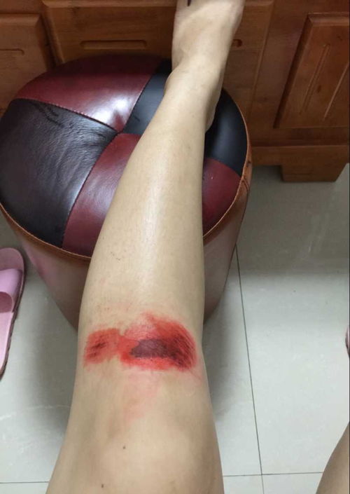 清香木叶干裂，如何恢复生机