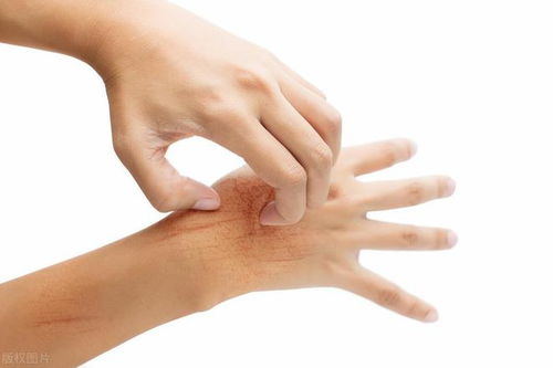 手掌沾农药痒得难受，怎么办？试试这些土方法这个！