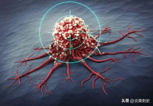 治疗玫瑰黄叶病，哪种药物效果最佳