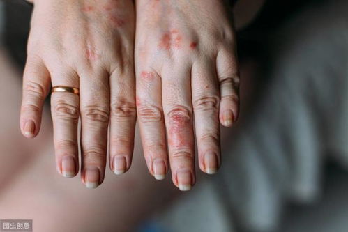 试试这些方法， 也许有用