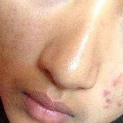迷迭香除螨效果显著吗？真的能彻底清除家中的螨虫吗