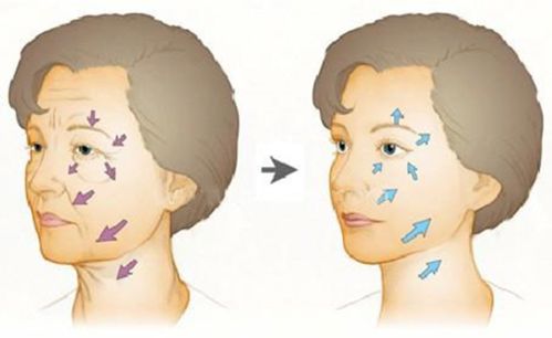 喷农药溅脸上， 痛得我眼泪汪汪