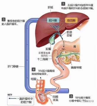 仔猪断奶后促生长策略研究