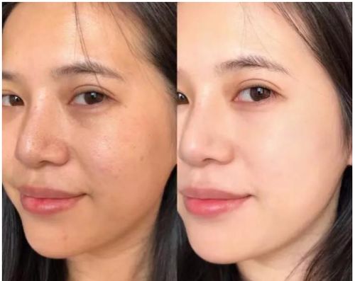 如何调理改善肤色