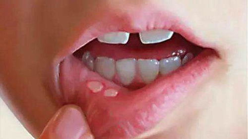 漫步自然的怀抱， 寻找烂嘴角治愈的温柔魔法