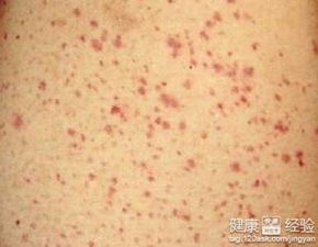 茄子秧枯萎病是个啥子病哦？