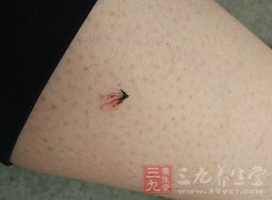 2、 室内室外杀蚊子的不同选择