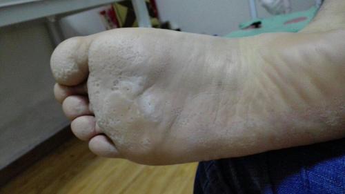 二、这玩意儿到底是怎么来的？我怀疑是脚趾头搞的鬼！