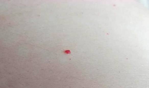 可Neng是农药过敏引起的